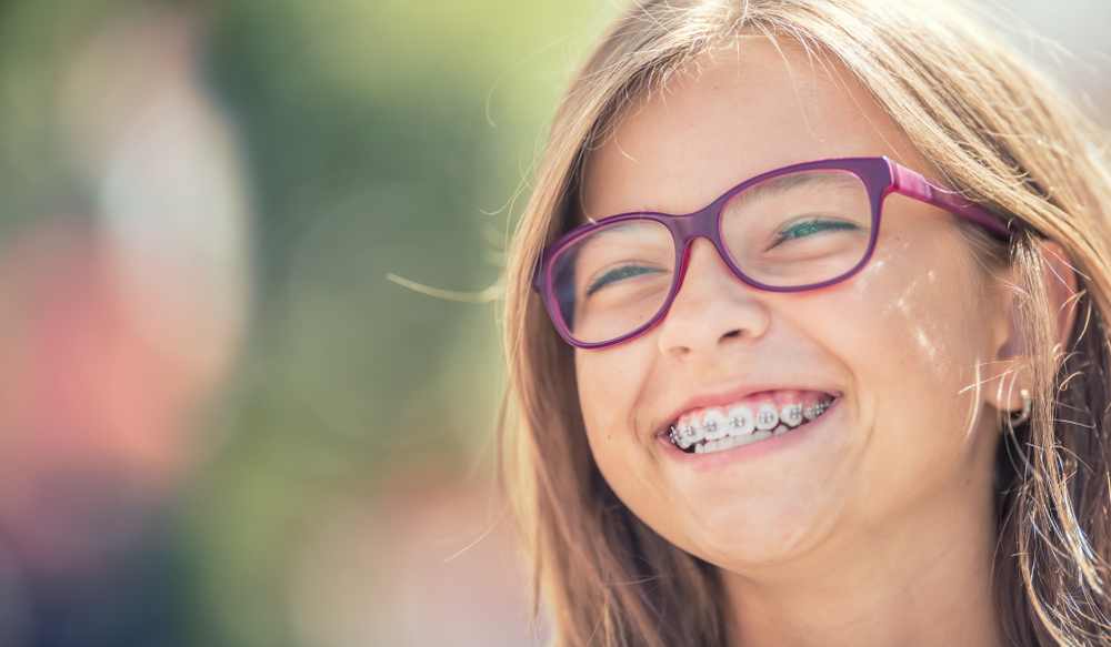 How To Fix An Overbite Without Braces - College Plaza Dental Associates