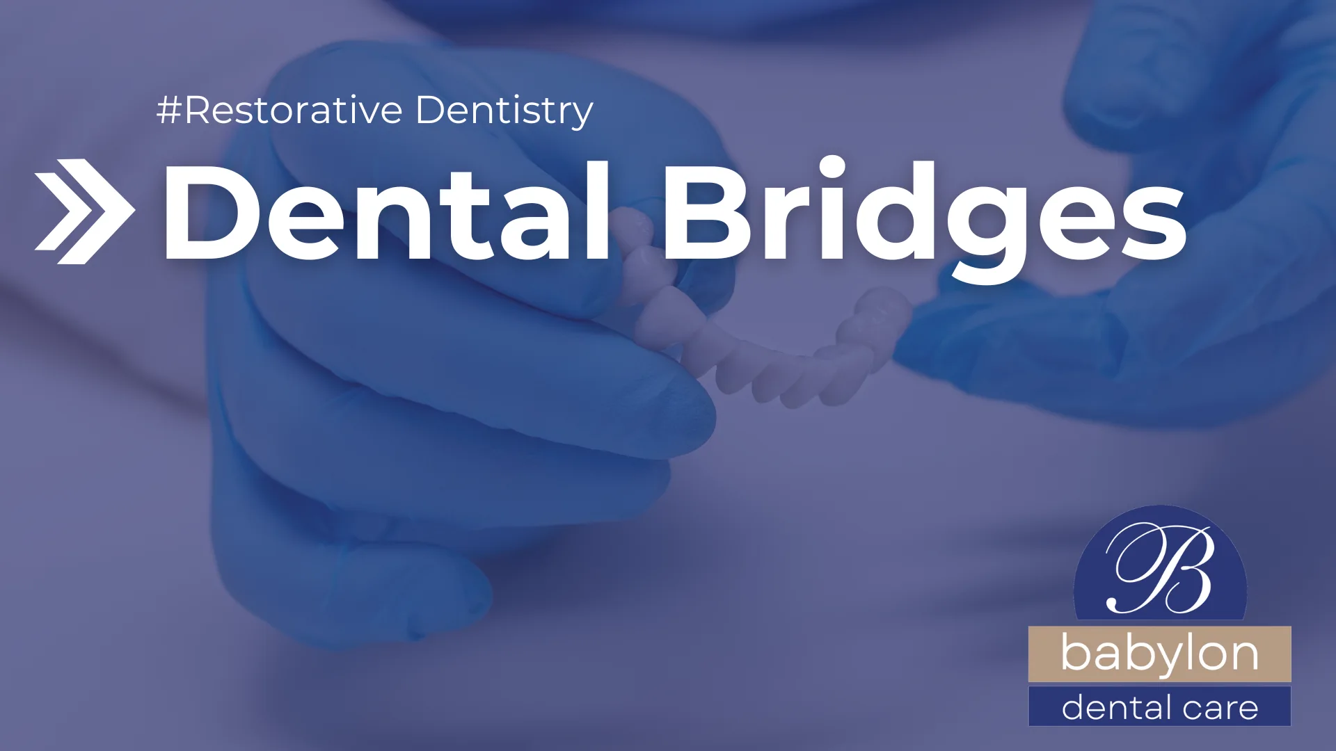 Dental Bridges Image - new logo