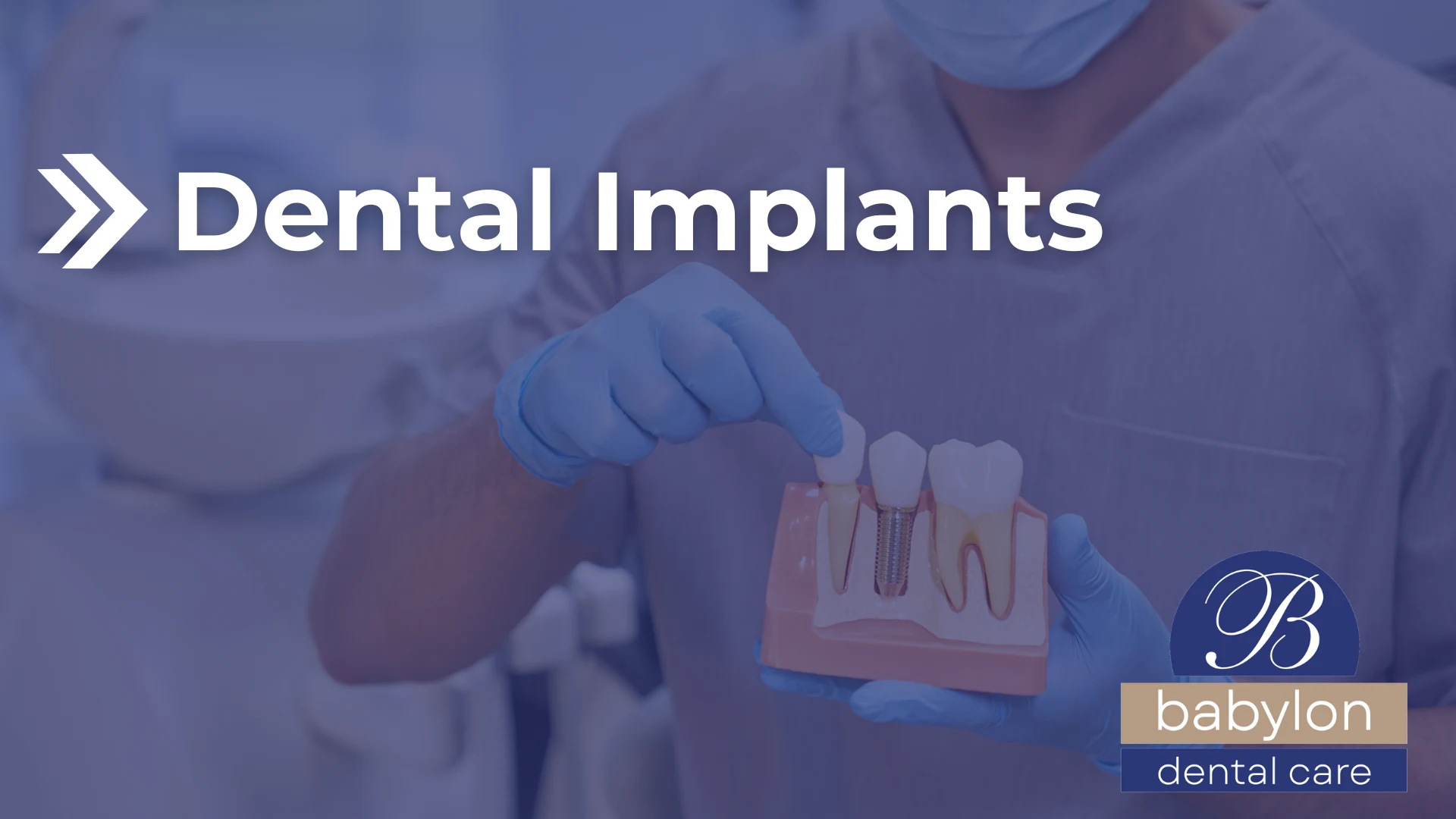 Dental Implants Image - new logo