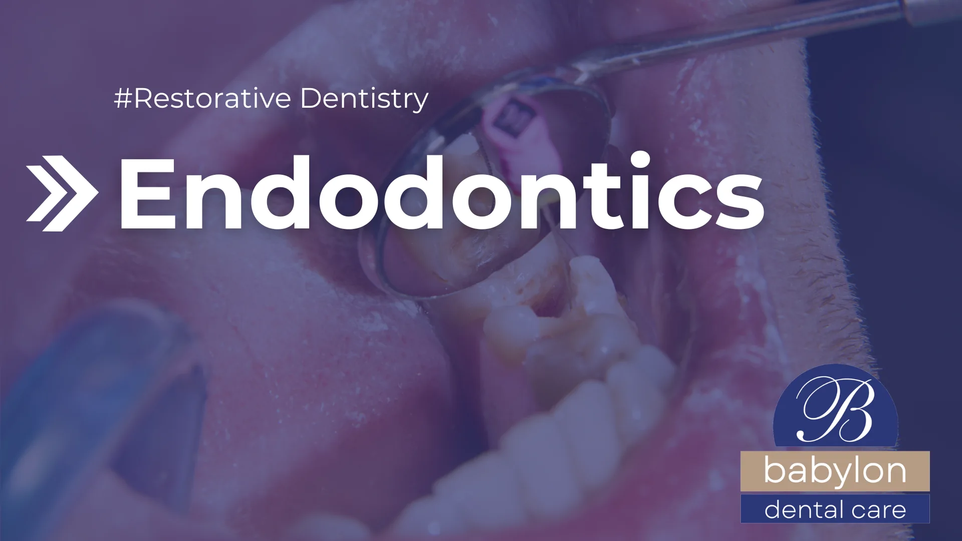 Endodontics Image - new logo