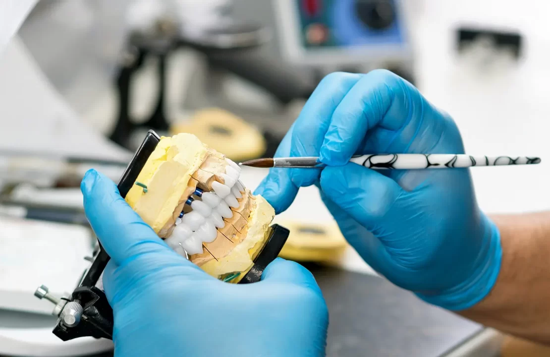 Full-Mouth Dental Reconstruction Process In New York Image raw