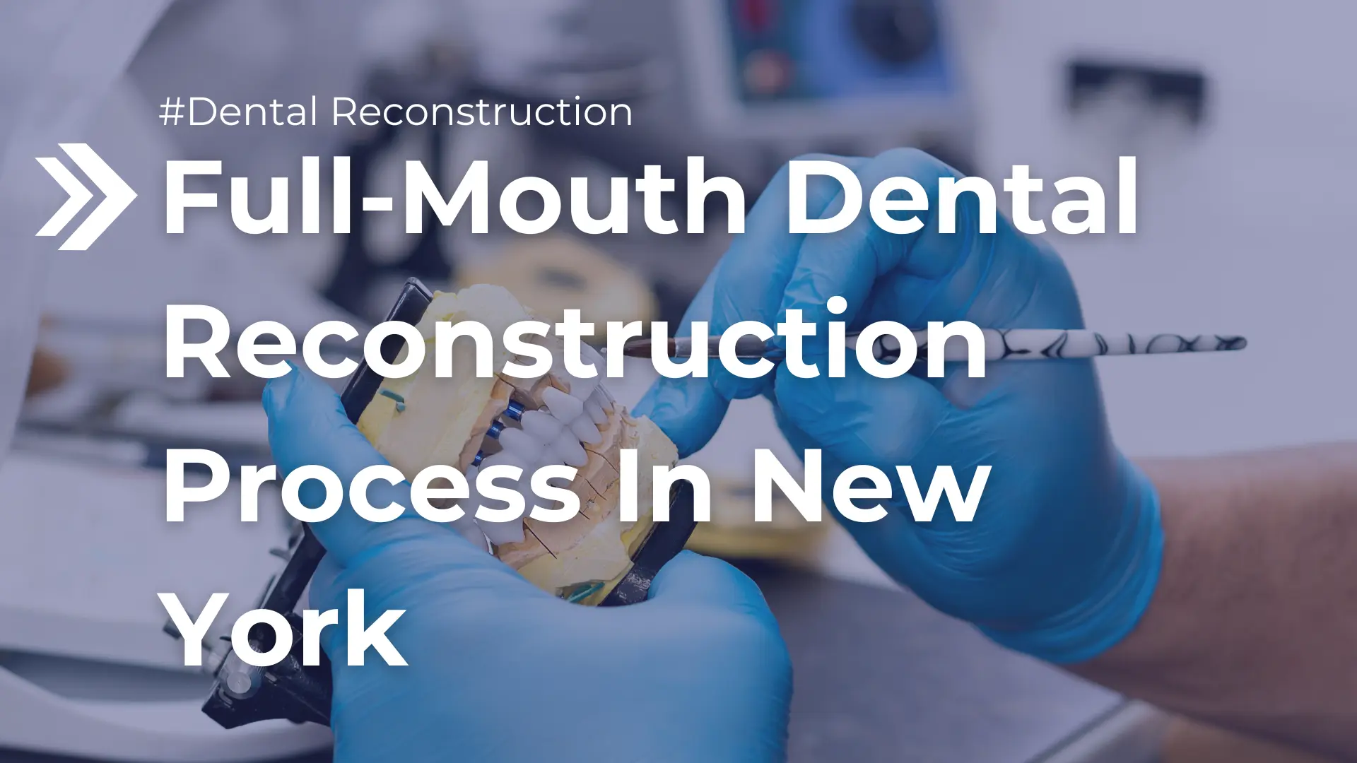 Full-Mouth Dental Reconstruction Process In New York Image