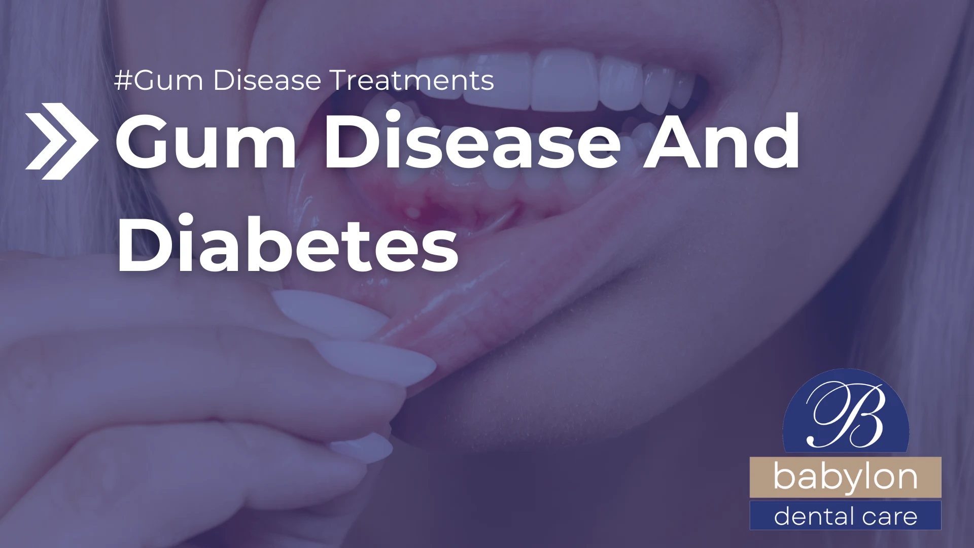 Gum Disease And Diabetes Image - new logo