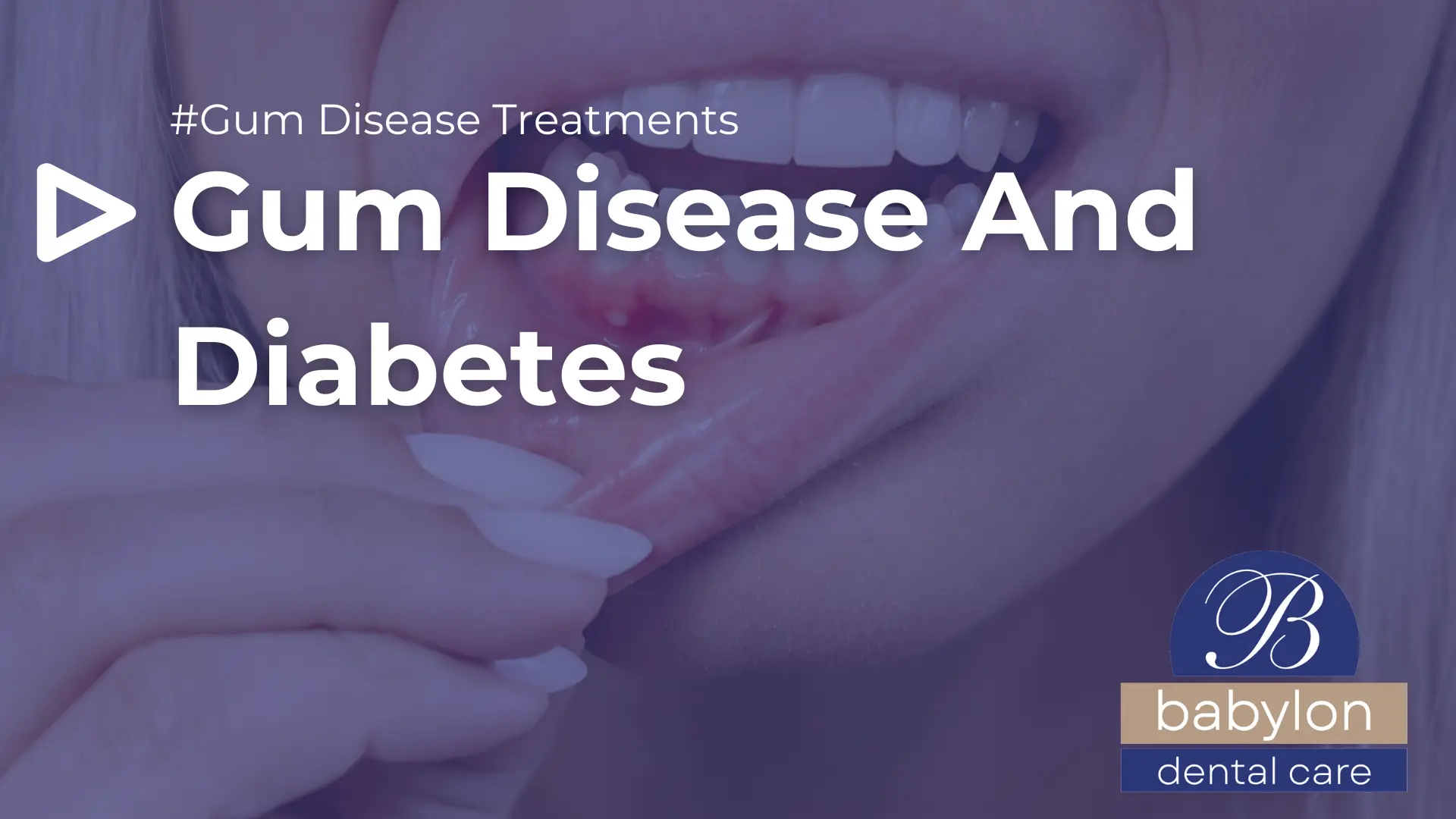 Gum Disease And Diabetes