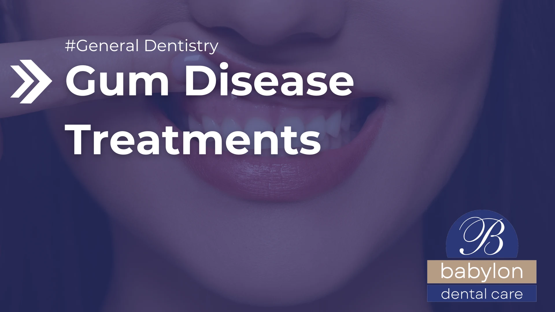Gum Disease Treatments Image - new logo