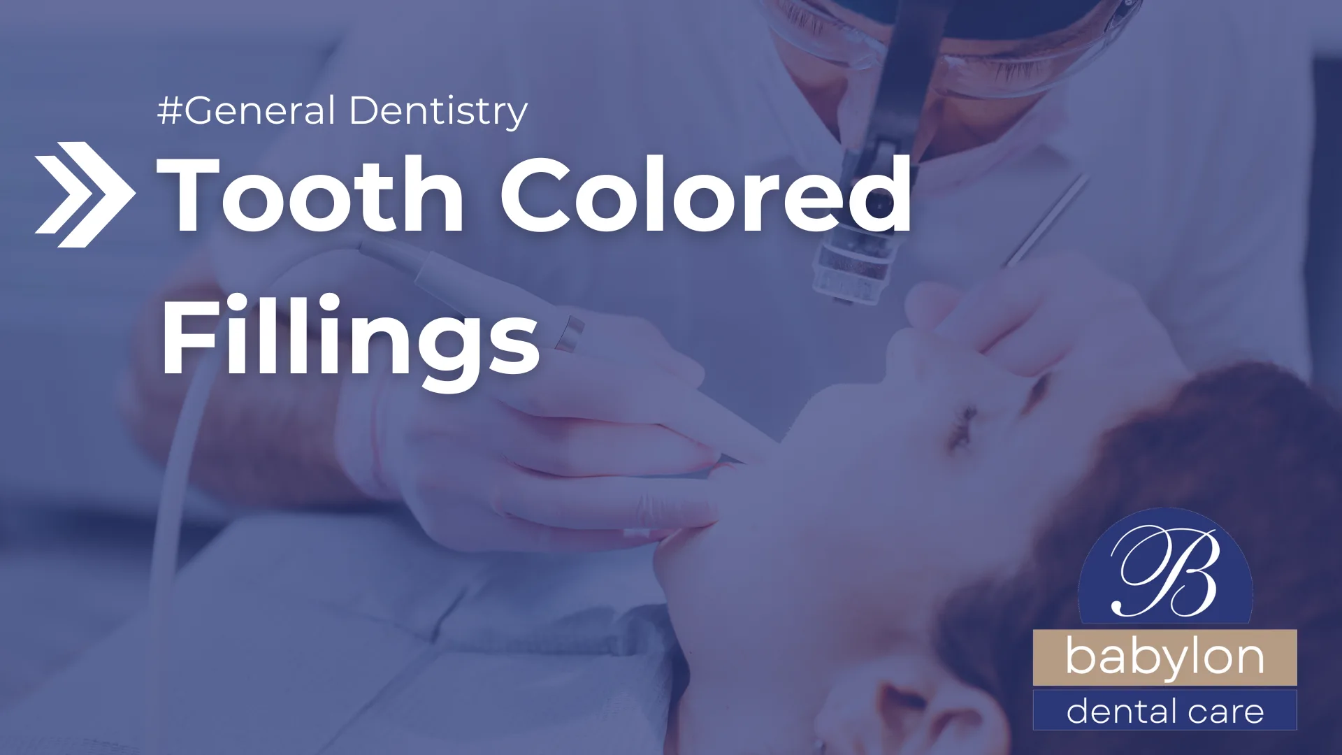 Tooth Colored Fillings Image - new logo