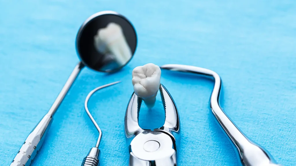 How to Avoid a Dry Socket After a Tooth Extraction Image 2