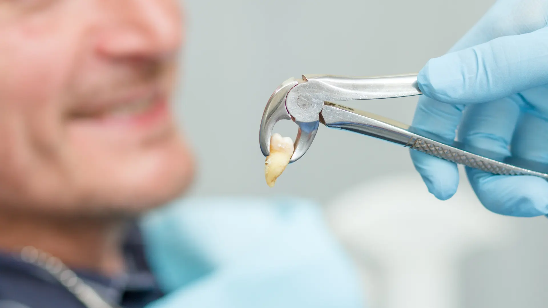 How to Avoid a Dry Socket After a Tooth Extraction Image raw